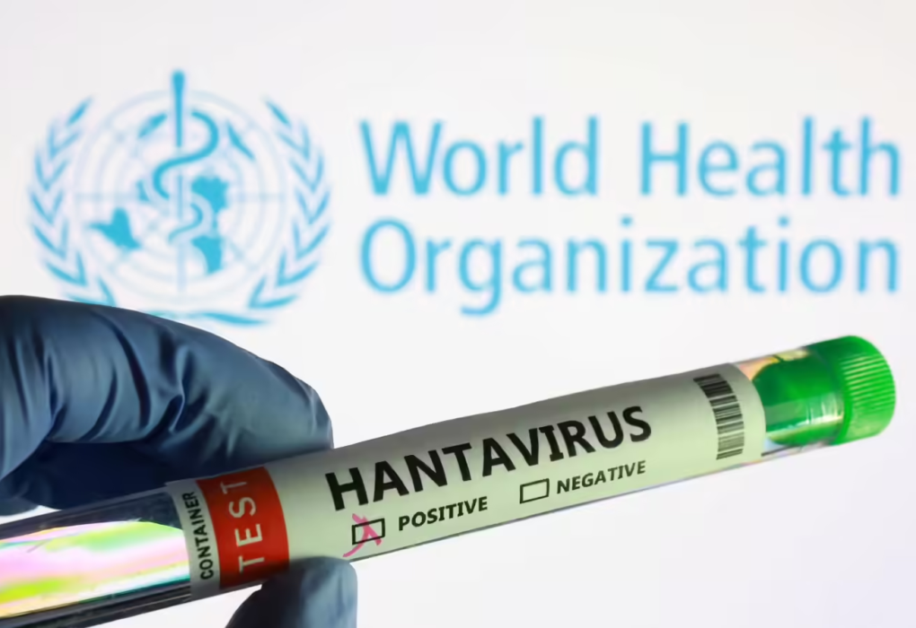Hantavirus Symptoms