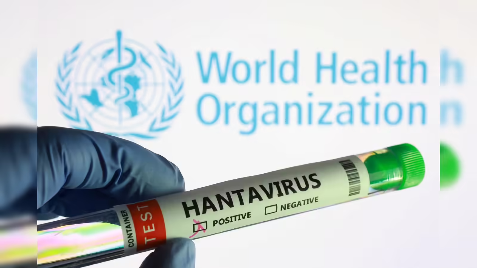 Hantavirus Symptoms