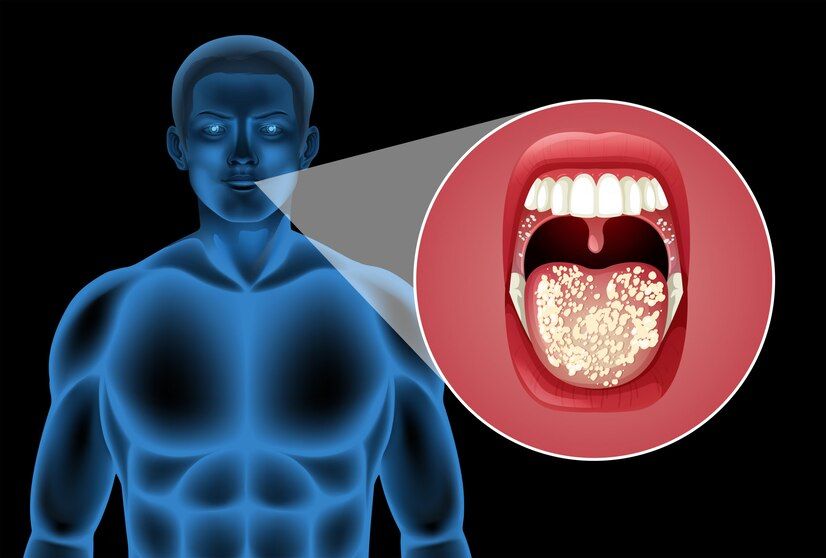 Oral Cancer Cases Gujarat