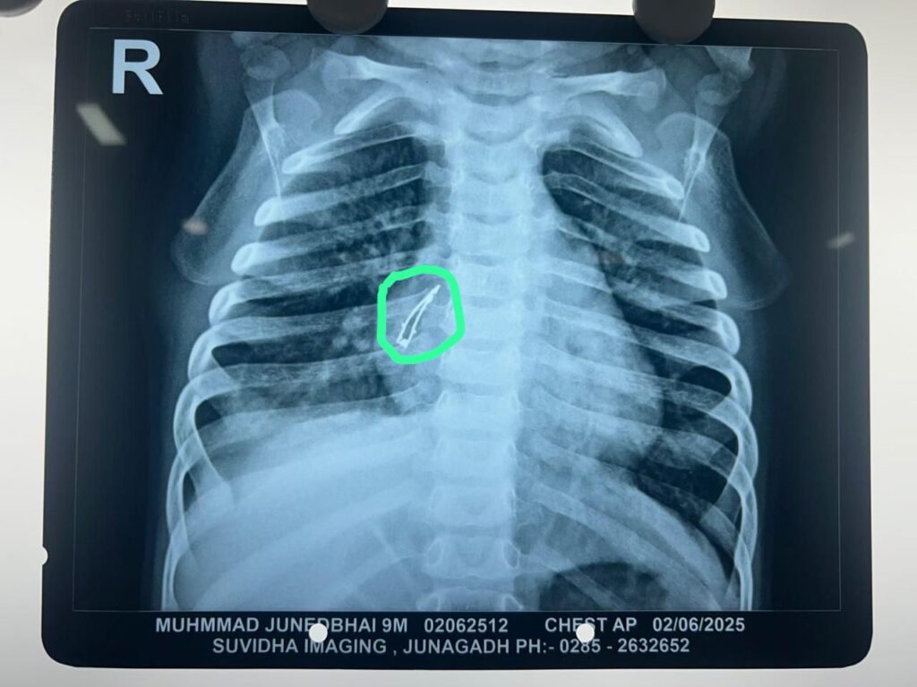 Gujarat Chid LED Bulb Removed