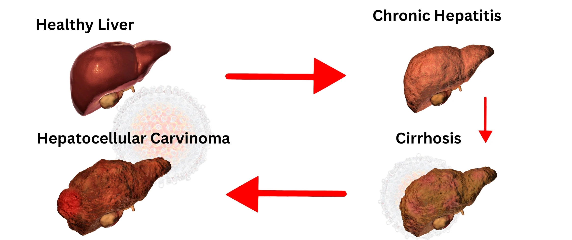 Kidney and Liver Failure Signs