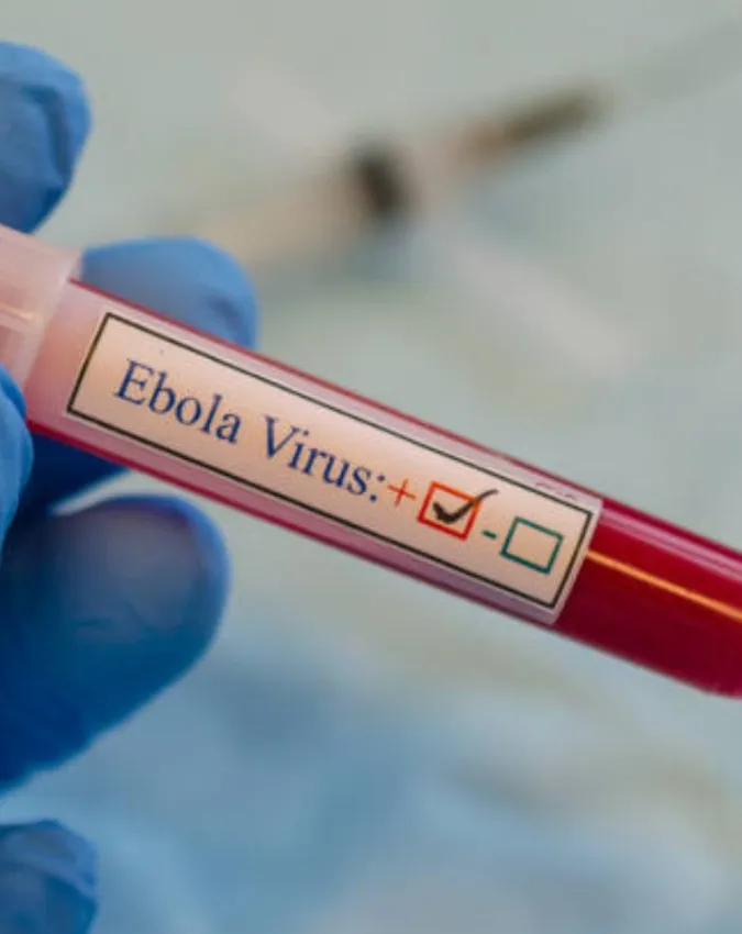 Ebola Virus