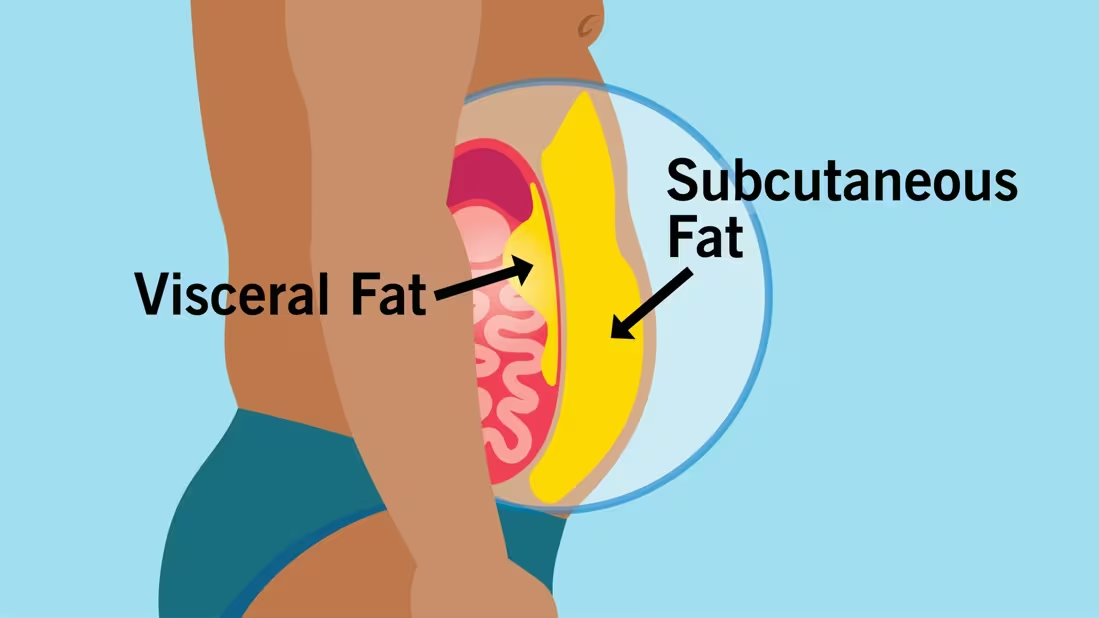 Belly Fat vs Visceral Fat